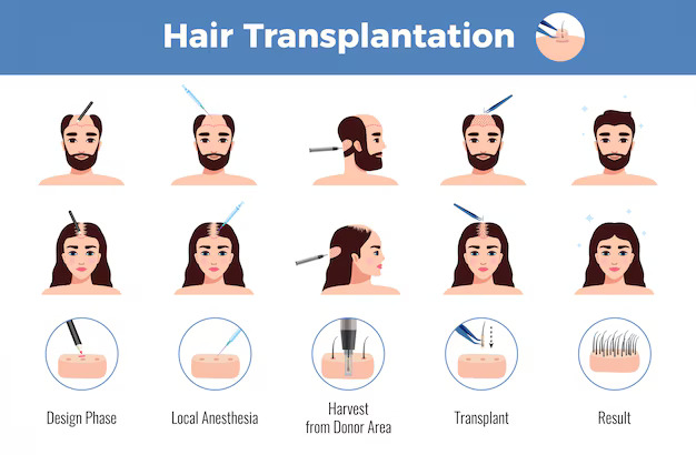 hair transplant surgeon in Lucknow