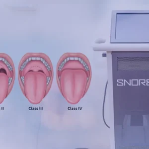 Snoring Treatment