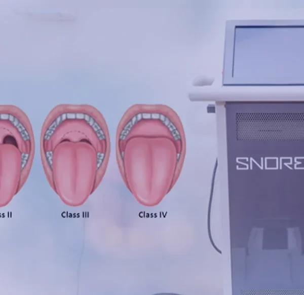 Snoring Treatment