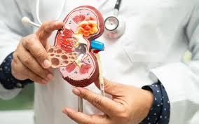 nephrologists